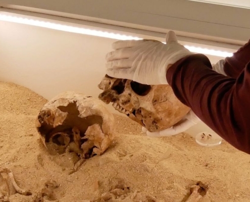 Rare Genetic Disease Discovered in Ancient Skeletal Embrace From The Ice Age : ScienceAlert