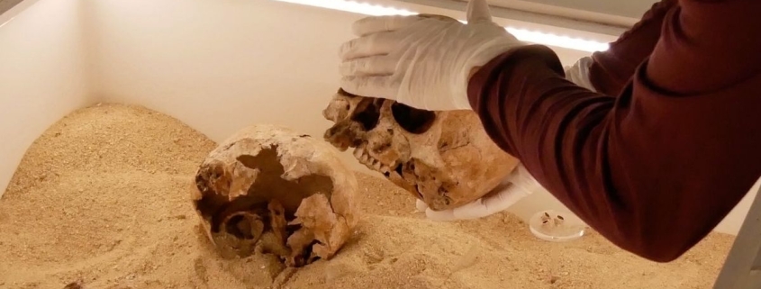 Rare Genetic Disease Discovered in Ancient Skeletal Embrace From The Ice Age : ScienceAlert