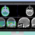 Apple’s Studio Display XDR Supports DICOM Medical Imaging for Diagnostic Radiology Apple’s Studio Display XDR Supports DICOM Medical Imaging for Diagnostic Radiology