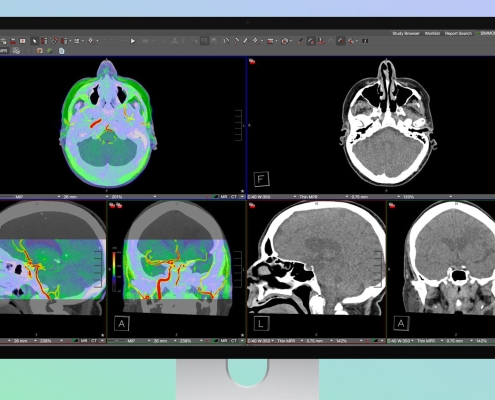 Apple’s Studio Display XDR Supports DICOM Medical Imaging for Diagnostic Radiology