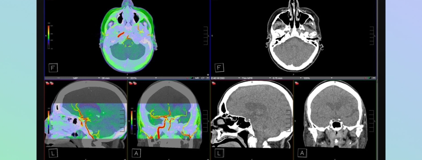 Apple’s Studio Display XDR Supports DICOM Medical Imaging for Diagnostic Radiology Apple’s Studio Display XDR Supports DICOM Medical Imaging for Diagnostic Radiology