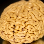 Superagers’ ‘Secret Ingredient’ May Be The Growth of New Brain Cells : ScienceAlert