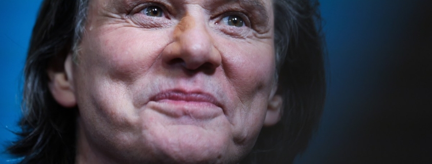 Famed Plastic Surgeon Weighs in on Jim Carrey’s Face