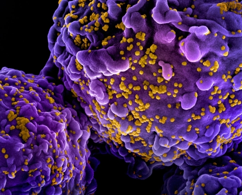 Norwegian Man Cured of HIV by His Brother’s Stem Cells