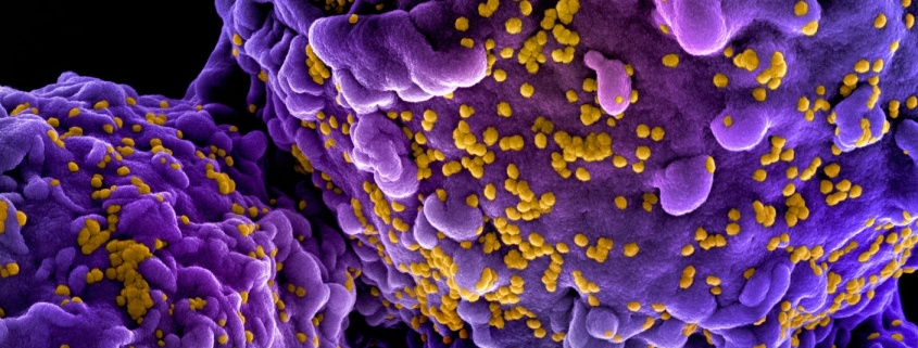 Norwegian Man Cured of HIV by His Brother’s Stem Cells
